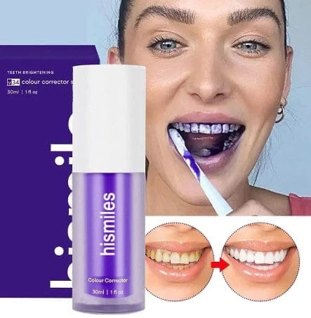 hismile v34 Teeth